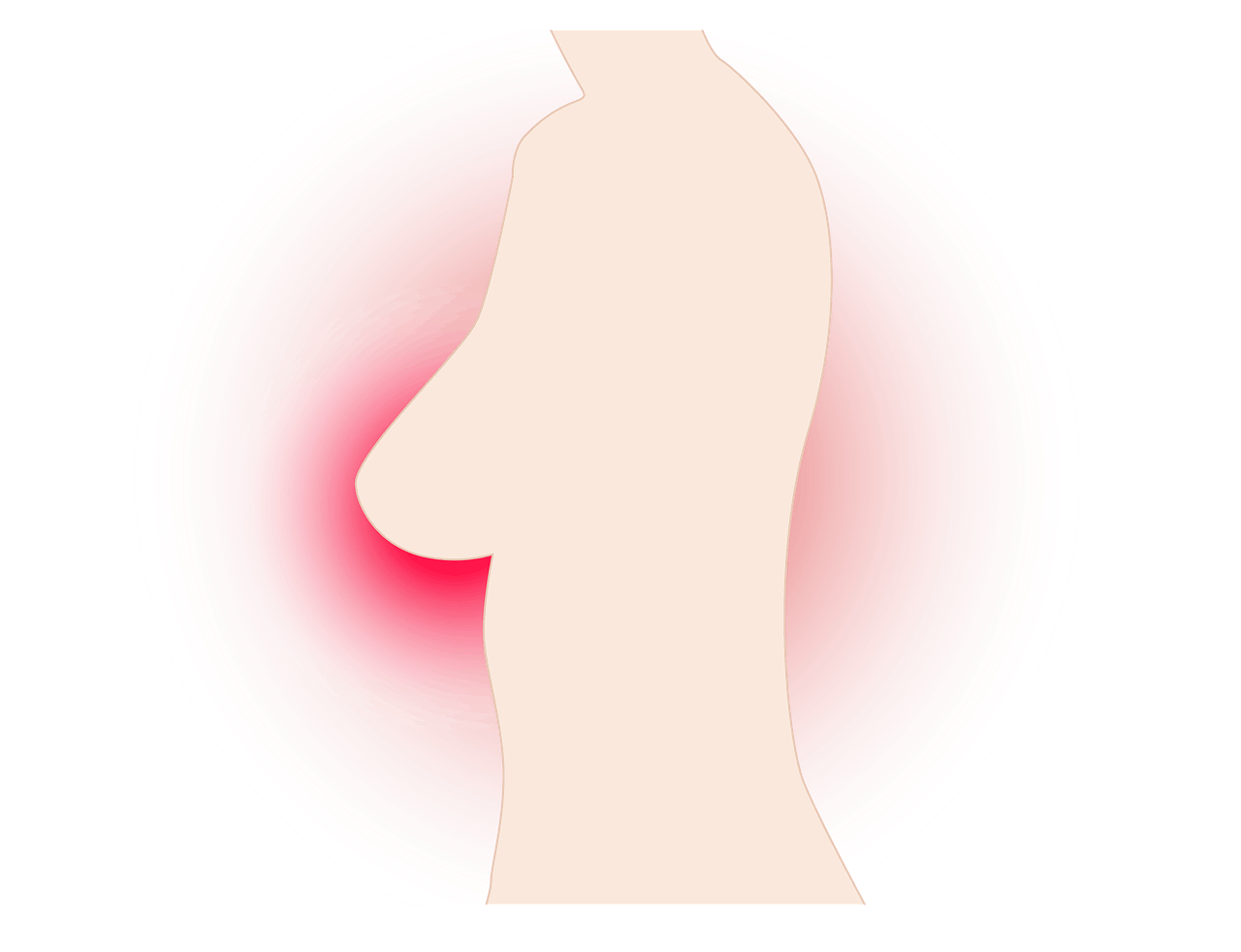 Brustentzündung in der Stillzeit Brust Brustkrebs Krebs Brustkrebs-Band Rosa