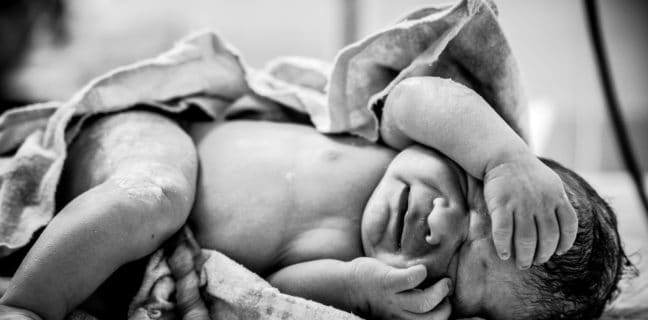 Hebammen äußern sich kritisch zum Geschäft mit Nabelschnurblut A newborn with a freshly cut umbilical cord lies on a table in the operating room.