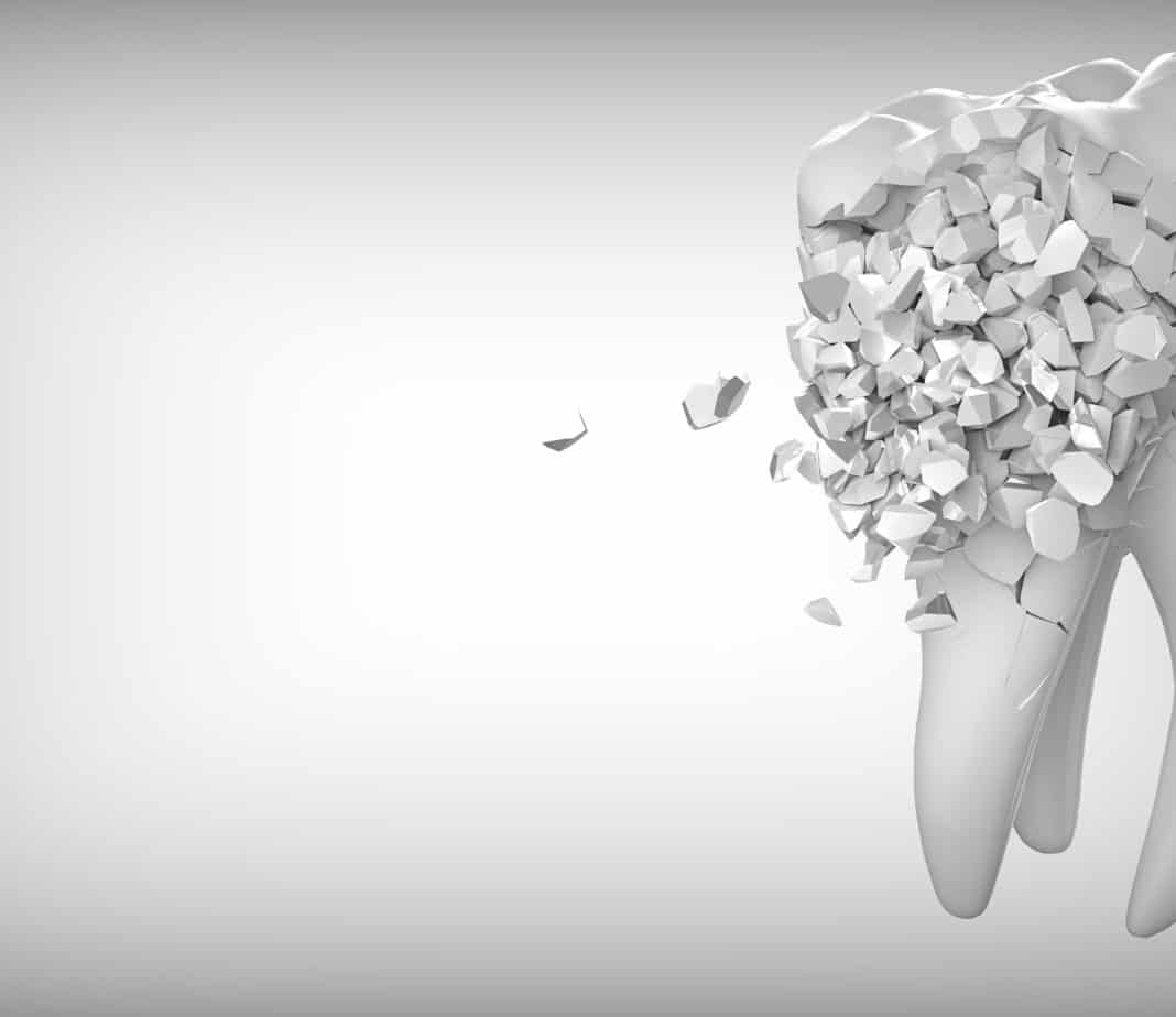 Zahn Erste Hilfe beim Zahnunfall Dein Zahn - erste Hilfe beim Zahnunfall, zahn, zahnheilkunde, das ist lustig