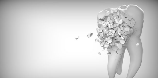 Zahn Erste Hilfe beim Zahnunfall Dein Zahn - erste Hilfe beim Zahnunfall, zahn, zahnheilkunde, das ist lustig