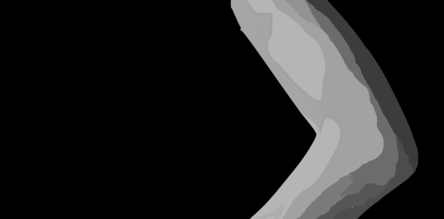 Sonntagsarm und harte Landung für fliegende Engel – Beliebtes Spiel: Engelchen flieg, doch nicht harmlos? Sonntagsarm, arm, Chassaignac-Lähmung, körperteil, mensch