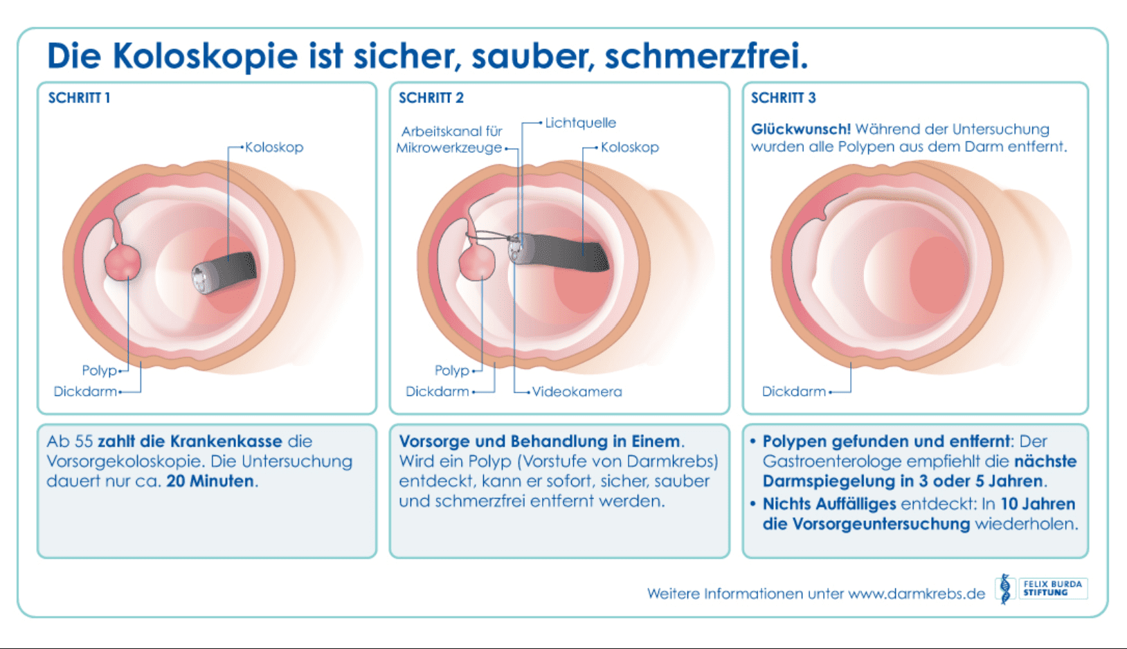 Was ist eine Koloskopie Quelle: Felix Burda Stiftung