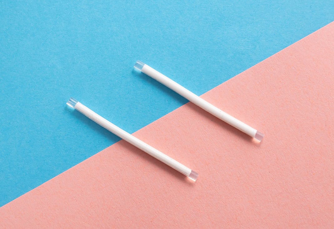 Alles über PCO-Syndrom: Symptome, Behandlung und Tipps Photo Hormonal imbalance