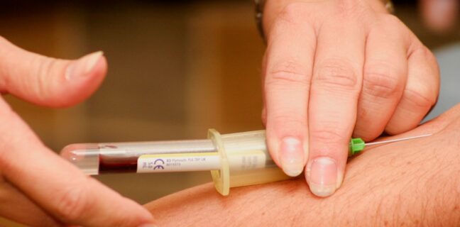 Was kosten ICSI-Behandlungen? Photo Medical bill