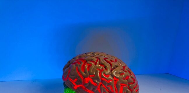 Ursachen von Alzheimer: Was du wissen solltest Photo Brain scan