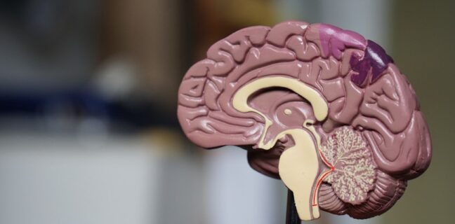 Was ist Alzheimer? – Eine Einführung für dich Photo Brain scan