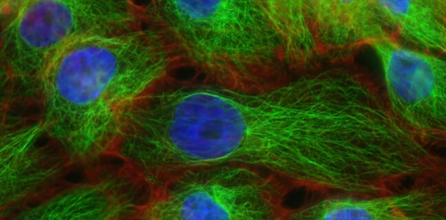 Kinderwunsch bei Männern: Tipps und Informationen Photo Sperm analysis