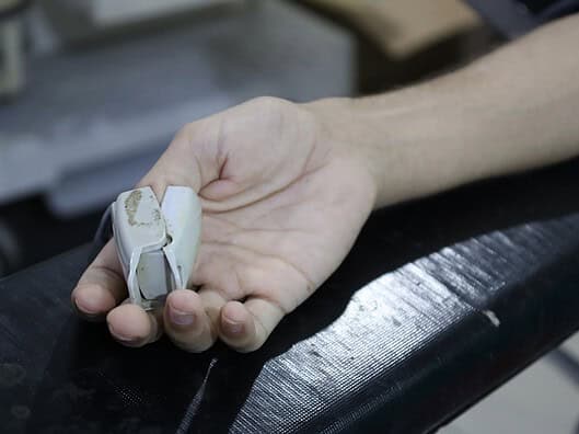 Alles über Vollnarkose bei Kaiserschnitt – Was du wissen musst Photo Operating room