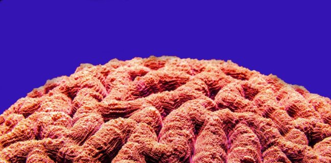 Alzheimer-Forschung: Was du über die neuesten Entwicklungen wissen solltest Photo Brain scan