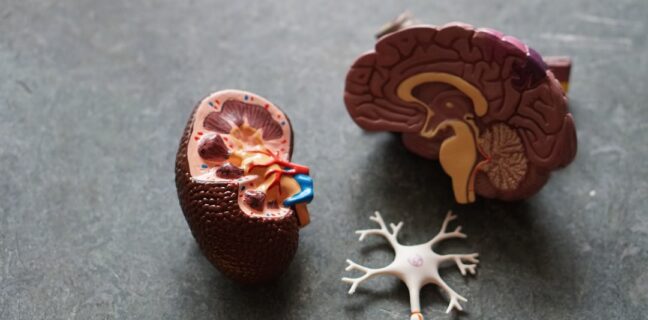 Diagnose von Alzheimer: Was du wissen musst Photo Brain scan