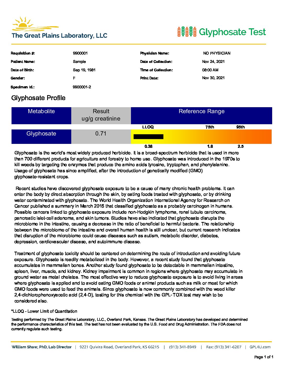 Glyphosate Test (urine) - Image 2