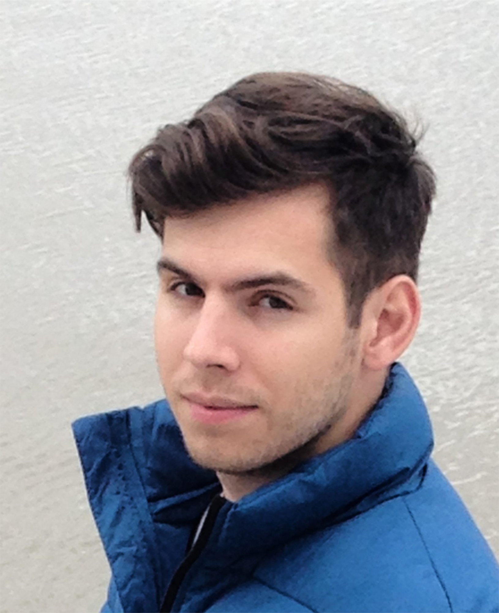 האם השתלת שיער בתורכיה היא דבר מסובך?