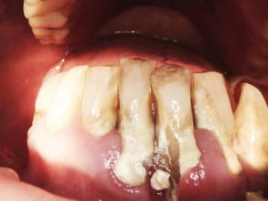 Zdjęcie kamerą wewnątrzustną