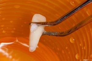 Złamany uśmiech dziecka (2 of 8)