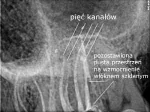 Potęga tomografii wolumetrycznej 3D