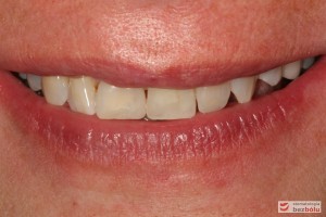 Radosny uśmiech pacjentki Radosny uśmiech pacjentki