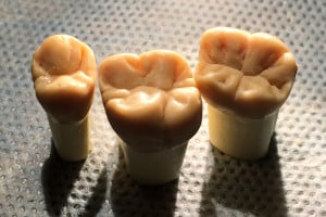 Sztuka modelowania w stomatologii - wyrzeźbione korony zębów Sztuka modelowania w stomatologii - wyrzeźbione korony zębów