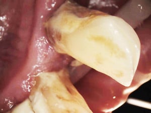 Zdjęcie kamerą wewnątrzustną