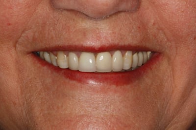 Uśmiech pacjenta radością lekarza