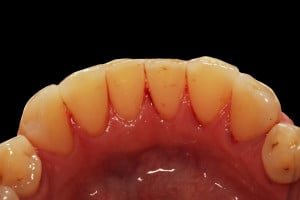 widok ze stronyjęzykowej