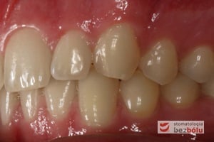 Strona lewa w zwarciu