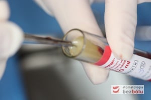 Probówka z zawartością fibryny bogatopłytkowej