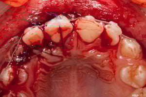 Złamany uśmiech dziecka (5 of 8)