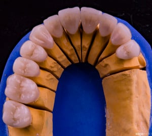 PRO-DENT-MZ-SM-praca-5