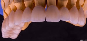 PRO-DENT-MZ-SM-praca-2