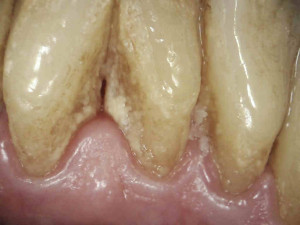 zdjęcie 4 – widok od strony językowej – kamera zewnątrzustna