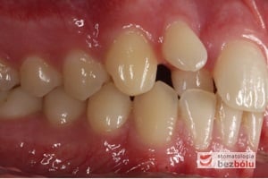 Strona prawa w zwarciu