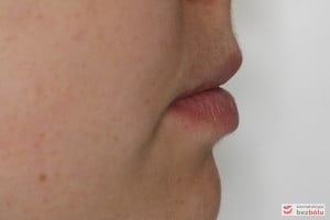 Profil pacjentki po leczeniu Profil pacjentki po leczeniu