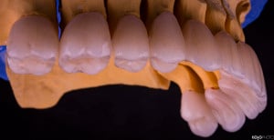 PRO-DENT-MZ-SM-praca-3