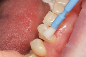 widok od strony przedsionkowej