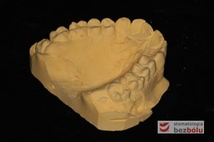 Model gipsowy podzielony przy pomocy wosku Model gipsowy podzielony przy pomocy wosku