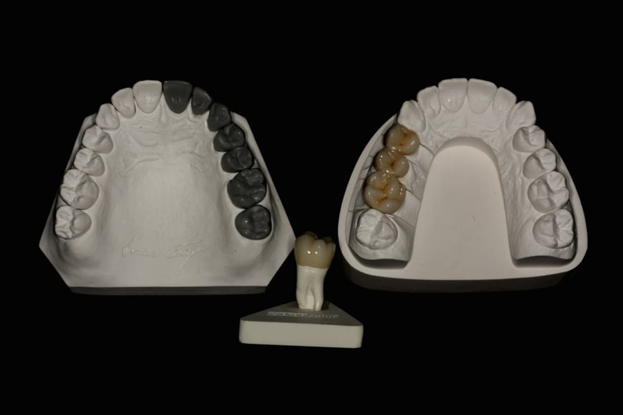 Praca protetyczna podsumowująca szkolenie Praca protetyczna podsumowująca szkolenie