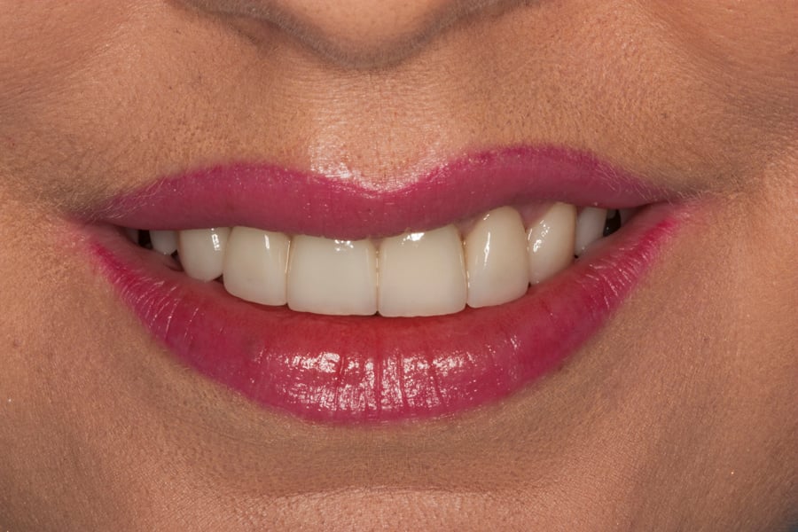 ortodontyczna_protetyczna_terapia