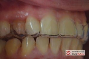 Zdjęcie przesłane przez pacjentkę w celu oceny efektów leczenia Zdjęcie przesłane przez pacjentkę w celu oceny efektów leczenia