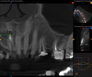 1-ScreenShot_1.2.250.1.90.3.2027043411.20170509175023.4980.32