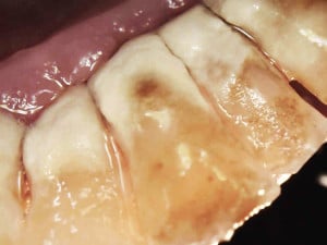 Zdjęcie kamerą wewnątrzustną