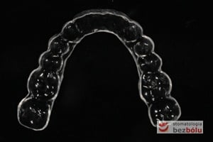 Przeźroczysta szyna dopasowana do kształtów anatomicznych zębów Przeźroczysta szyna dopasowana do kształtów anatomicznych zębów