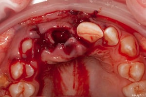 Złamany uśmiech dziecka (1 of 8)