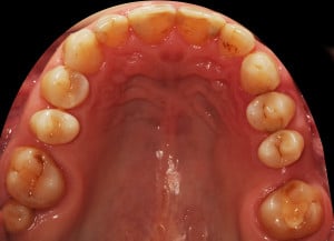 widok od strony podniebiennej