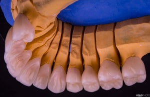 PRO-DENT-MZ-SM-praca-4