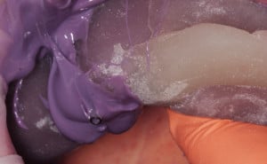 Pobieranie wycisku z transferem wyciskowym masą polieterową