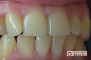 Zdjęcie przesłane przez pacjentkę w celu oceny efektów leczenia Zdjęcie przesłane przez pacjentkę w celu oceny efektów leczenia