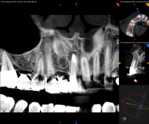 2-ScreenShot_1.2.250.1.90.3.2027043411.20180313135338.2932.32