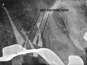Potęga mikroskopu 2