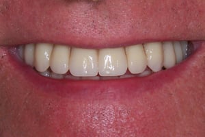 O takie zęby mi chodziło O takie zęby mi chodziło