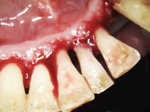 Zdjęcia kamerą wewnątrzustną